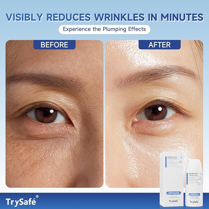 1.06oz PDRN & Calcium & Copper Peptides Temporary Eye Tightener - Reduce Eye Bags, Puffy Eyes, Dark Circles & Firm Wrinkle, Smile Line Instantly* | Hyaluronic, Collagen, Kojic, Caffeine