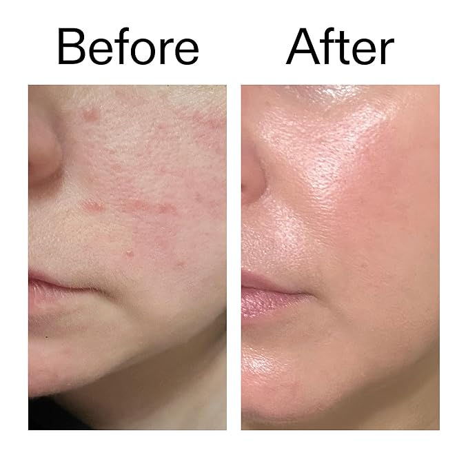 The INKEY List Exosome Hydro-Glow Complex, Boosts Collagen Production, Rejuvanating Skincare, Advanced Hydration, Suitable For All Skin Types