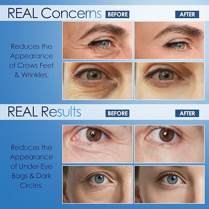 Instant Visible Reduction Serum - Visibly Reduces Under-Eye Bags, Wrinkles, Dark Circles, Fine Lines & Crow's Feet, (0.17 Fl Oz (Pack of 1))