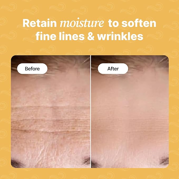 Bayside Forehead Wrinkle Patches – 20 Anti-Aging Forehead Pads with Vitamin C, Hyaluronic Acid, Collagen, Snail Mucin & Retinol – Reduce the Appearance of Forehead Lines