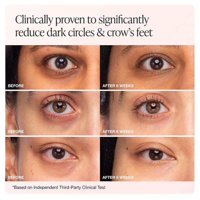 Innbeauty Project Bright & Tight Eye Cream with Vitamin C & Peptides for Dark Circles & Firming, 0.5 OZ (15ml) (Refill)