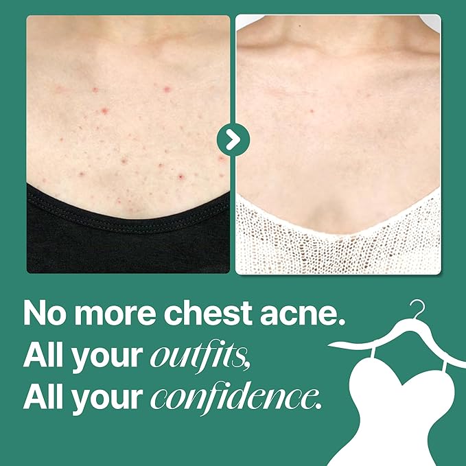 SOME BY MI AHA BHA PHA 30 Days Miracle Acne Clear Body Cleanser - Pack of 2 - Daily Exfoliating Tea Tree Acne Body Wash with Salicylic Acid - Deep Cleanses Sebum and Impurities - Korean Skin Care