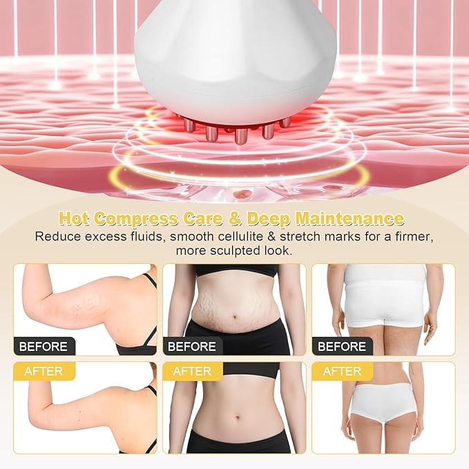Lymphatic Drainage Massager & Anti Cellulite Massage Tool, Body Sculpting Machine Helps Reduce Stretch Marks & Cellulite, Ideal Pain Relief Devices for Sciatica Nerve, Legs, Arms, Belly