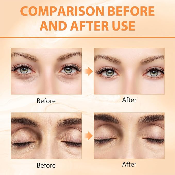 2PCS Revive Glow Vitamin C Eye Balm, Vc Anti-Wrinkle Eye Serum Oil,Reducing Dark Circle,Hydrating Eye Cream,Improve Dark Circles,Reduces Puffiness (2pcs)