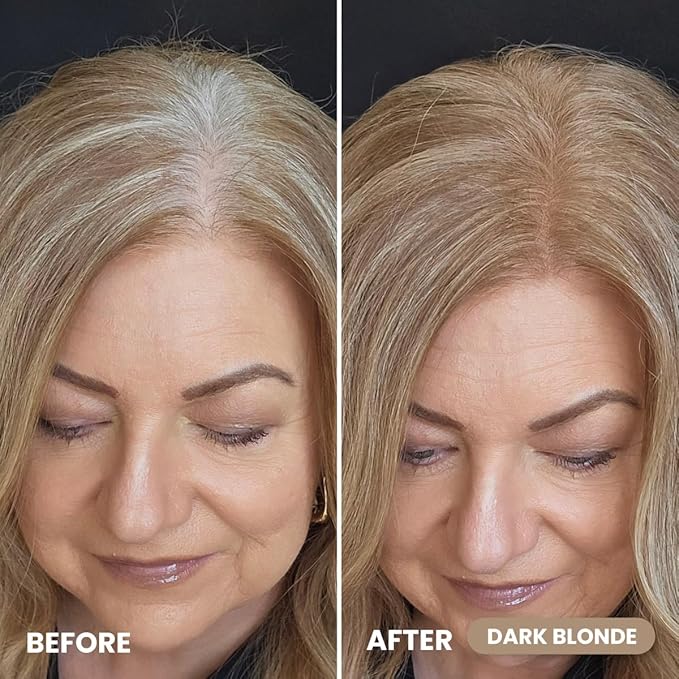 Prime Prometics Instant Coverage Hairline Powder for Mature Women – Covers Grays, Roots & Thinning Areas – Water & Sweat-Resistant – Natural, Fuller-Looking Hairline (Dark Blonde)