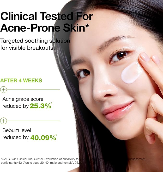 Anua Azelaic Acid CICA Skin Soothing Moisturizer, Lightweight & Redness Relief, for Acne Prone Skin, Fragrance Free, Korean Skincare, 3.38 fl oz