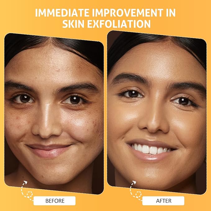 Easter Gifts for Women Pumpkin Enzyme Face Mask Skincare| Brightening Exfoliating Facial Mask For Dead Skin,Dullness Dark Spots, Uneven Skin Tone,Large Pores and Brightens Skin