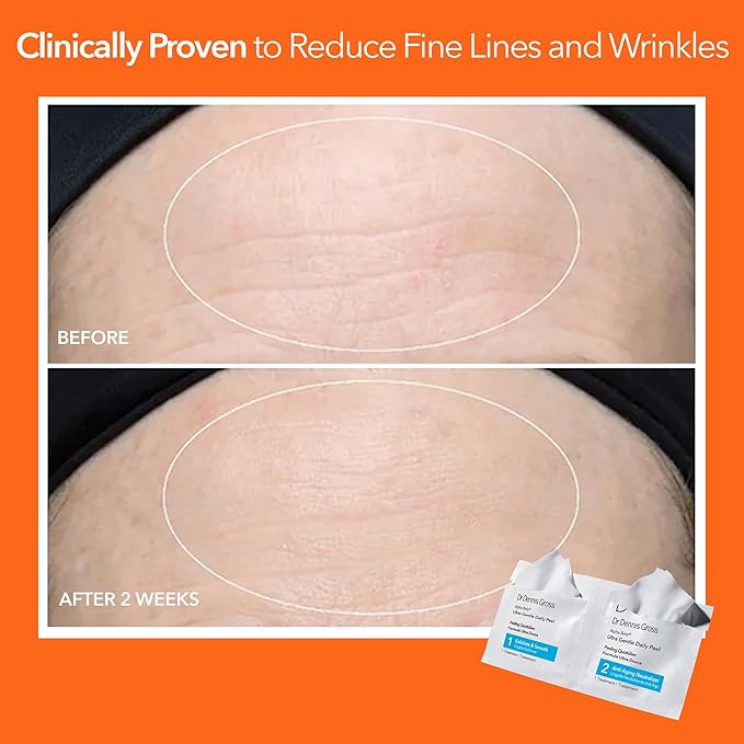 Dr. Dennis Gross Alpha Beta Ultra Gentle Daily Peel: for Dehydrated or Sensitive Skin, Uneven Tone or Texture, Fine Lines or Enlarged Pores (5 Treatments)