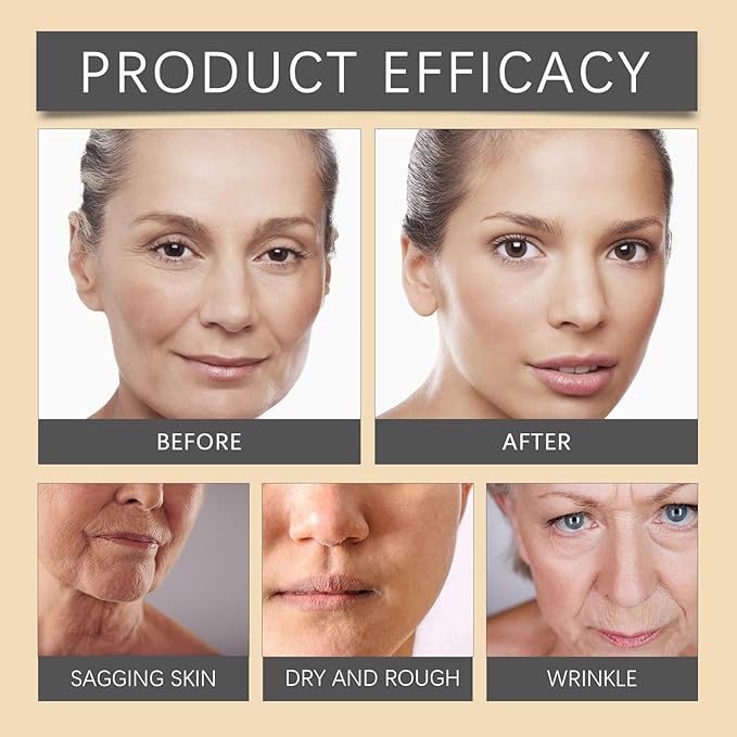 Bee Venom Wrinkle Removal Cream, Bee Venom Anti-Wrinkle Firming Cream, bee venom firming serum stick, Moisturizing, Lifting & Recovery - All Skin Types - Anti-Aging 2PCS