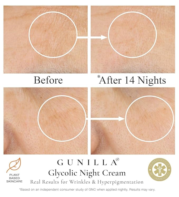 GUNILLA Glycolic Acid Night Cream - Refine, Resurface & Reduce Fine Lines, Wrinkles, Dark Spots, Congested Pores While Brightening Complexion. Gentle - Natural - Vegan (2 oz)