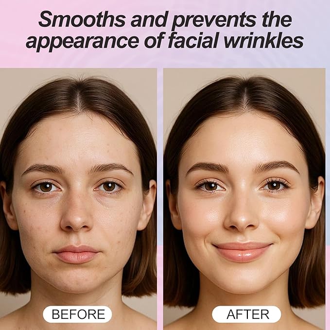 Facial Wrinkle Patches, Anti Wrinkle Facial Patches, Fine Line Remover Strips for Eye, Mouth, Frown, Smile Lines, Crows Feet, Lift Effect– 90 Count