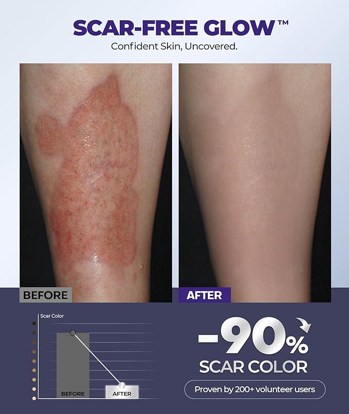 Silicone Scar Cream with 6.7% Active Ingredients, Scar Gel Visible in 2 Weeks, Moisturizing Scar Removal Clinically Show for Surgical, C-Section, Keloid, Acne & Burn Scars, Stretch Mark Cream(55ML)