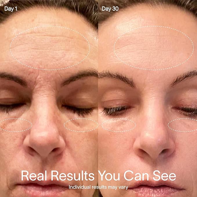 Solawave 4-in-1 Red Light Therapy Wand + Activating Serum | LED Skincare Device for Face & Neck | Facial Tool with Galvanic Current, Massage & Therapeutic Warmth | Reduces Appearance of Fine Lines