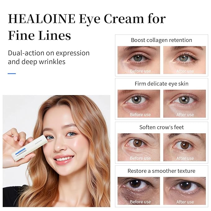 Eye Cream Stick for Dark Circles & Wrinkles – Korean Under Eye Balm Treatment with Avocado & Almond Oil, Firming & Hydrating, Puffiness & Fine Line Care, Travel-Friendly