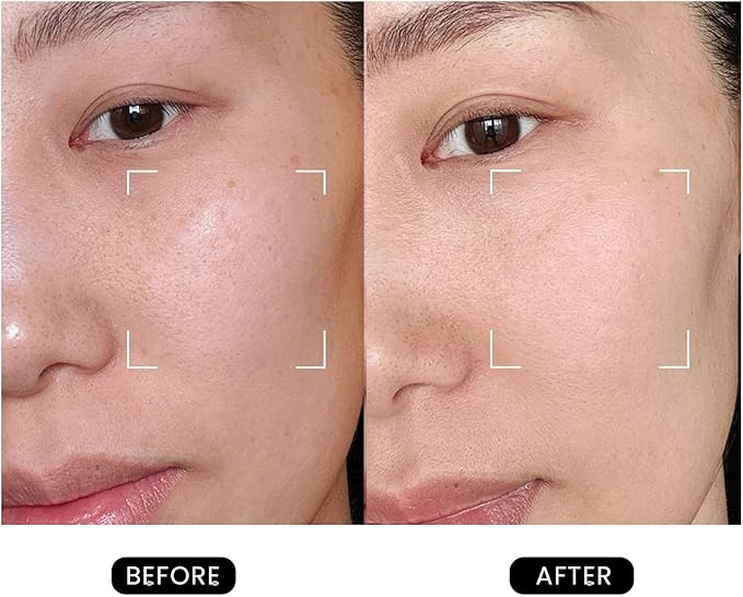 DermRays Revive Skincare for Anti-Aging, Glow Like Never Before,Multifunctional Beauty Device, Facial Massager for Home Use