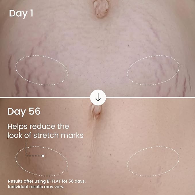 MAËLYS B-FLAT Belly Firming Cream for Women - Skin Tightening & Moisturizing Treatment with Shea Butter & Bentonite Clay - Smooths Look of Stretch Marks - Postpartum Body Care (2 Pack)