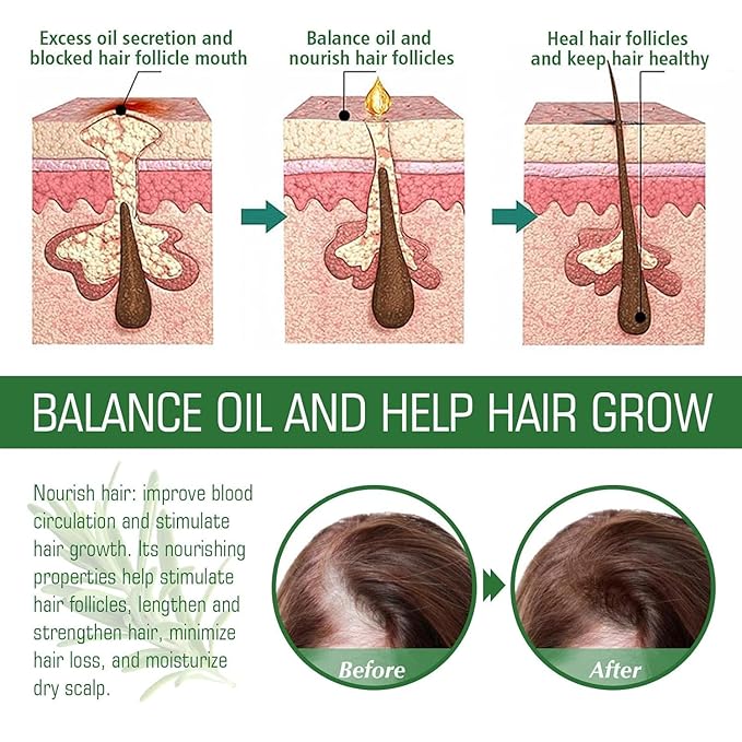 Aceite de Romero para Crecimiento y Tratamiento Capilar, Gotero para Estimular el Crecimiento del Cabello y Prevenir la Caída, 60ML/2.2 Fl Oz (2 Unidades)