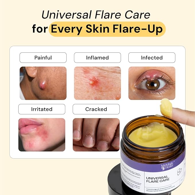 MyMagicHealer Universal Flare Care | Drawing Salve for HS, Boils, Cysts, Hemorrhoids, Pilonidal Cyst, Abscess | Anti-Chafing, Wound Care, Relief for Itching Skin w/Propolis & Egg Yolk Extract 4 oz