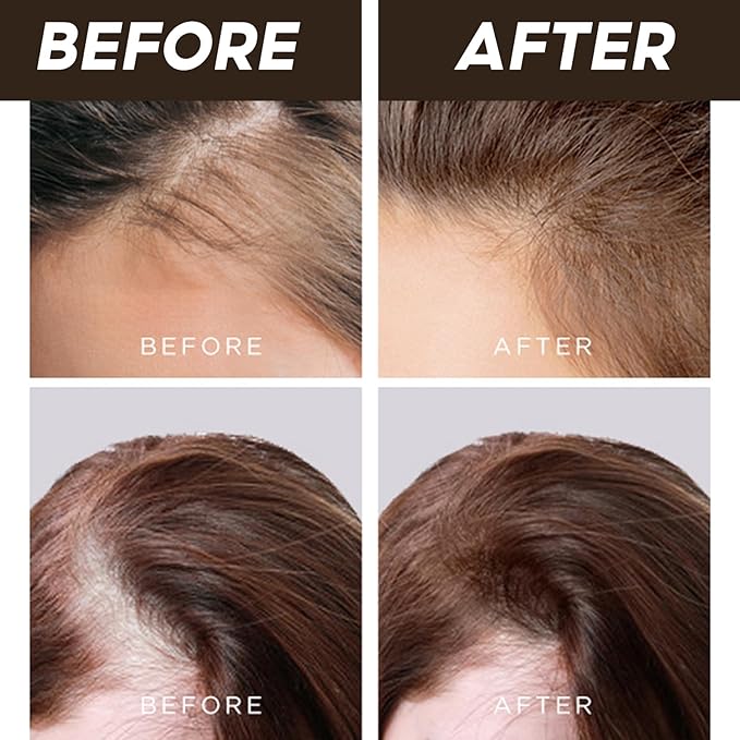 LALACHUU Hair Powder, Hair Powder for Women & Men Root Touch Up Hair Color, Hairline Powder Instantly Gray Water-Resistant Bald Spot Concealer 0.53 Ounce, Dark Brown