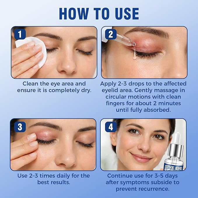 Stye Eye Treatment, Natural Relief Serum for Styes, Chalazions and Blepharitis, Blepharitis Treatment for Eyelids, Quickly Relieves Eyelid Irritation and Restores Healthier Skin, 30ML