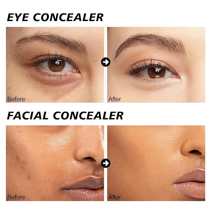 Erinde Full Coverage Tattoo Cover Up Makeup Waterproof, Under Eye Concealer for Dark Circles, Color Corrector, Long-Lasting Cream Concealer for Tattoos Scars & Face Blemishes Redness, 04 Nougatine