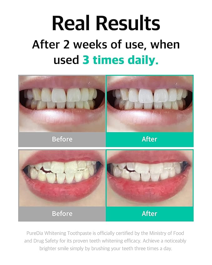 LiveOrals Whitening Toothpaste 80g x 3 – Fluoride-Free, Nano Hydroxyapatite & Hydrogen Peroxide, Sensitive Teeth, Enamel Strengthening, Natural Mint Gel