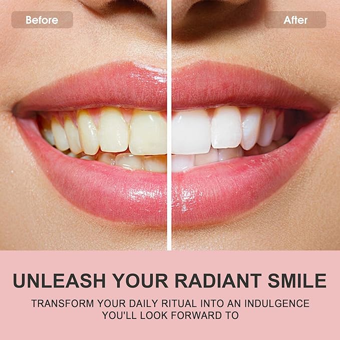 Hotluck Niacinamide Whitening Toothpaste - Brightening, Stain Removal, Freshening Breath - Deep Gentle Cleaning Tooth Paste, Boosting Gum Health, Mint & Peach 3.53oz (Pack of 4)