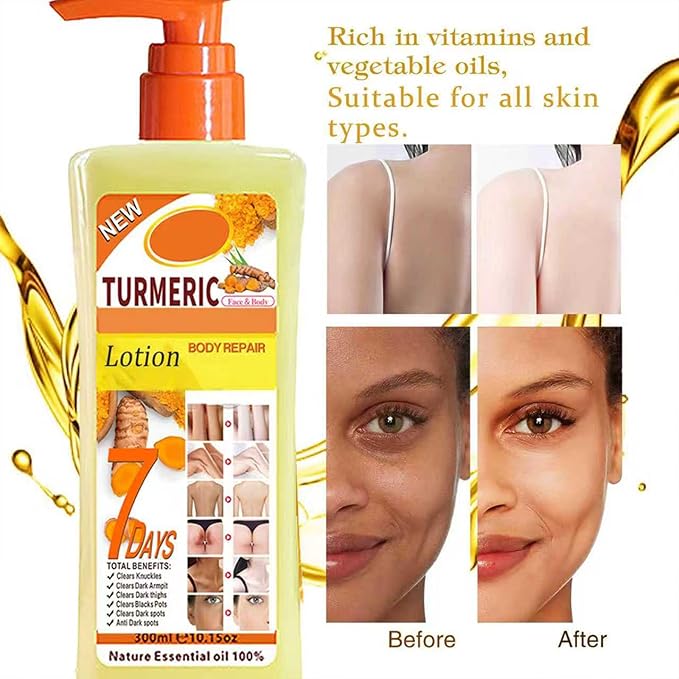 Soft 7 Turmeric Body Oil Lotion, Turmeric Oil Lotion for Skin Hyperpigmentation, Tumeric Lotions for Bodys, Body Lotions for Women Moisturizing & Smoothing for All Skin Types 10 Fl Oz