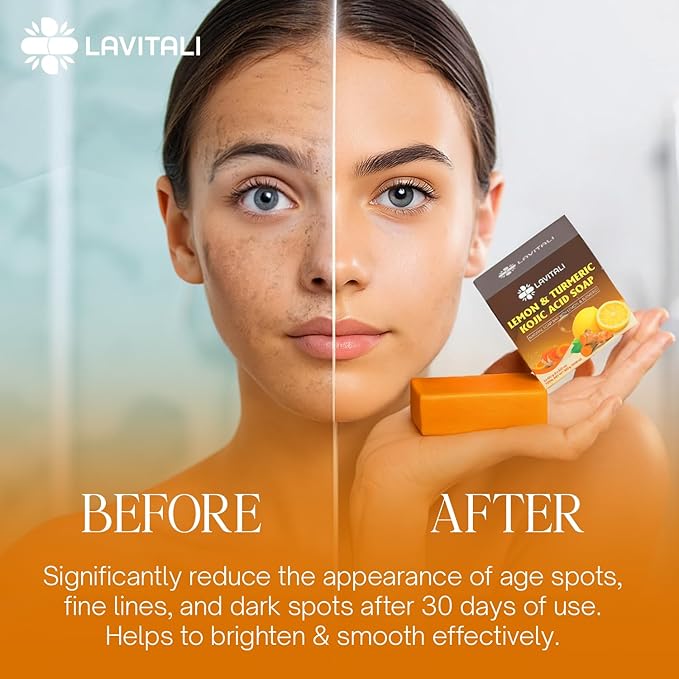 LaVitali, Premium 6 Bars Kojic Acid Soat with Lemon Turmeric, Natural soap, Handmade, Sugar/Caffeine/Gluten Free, 100% Natural & Pure, Great For All Skin Types Body Care Body Wash