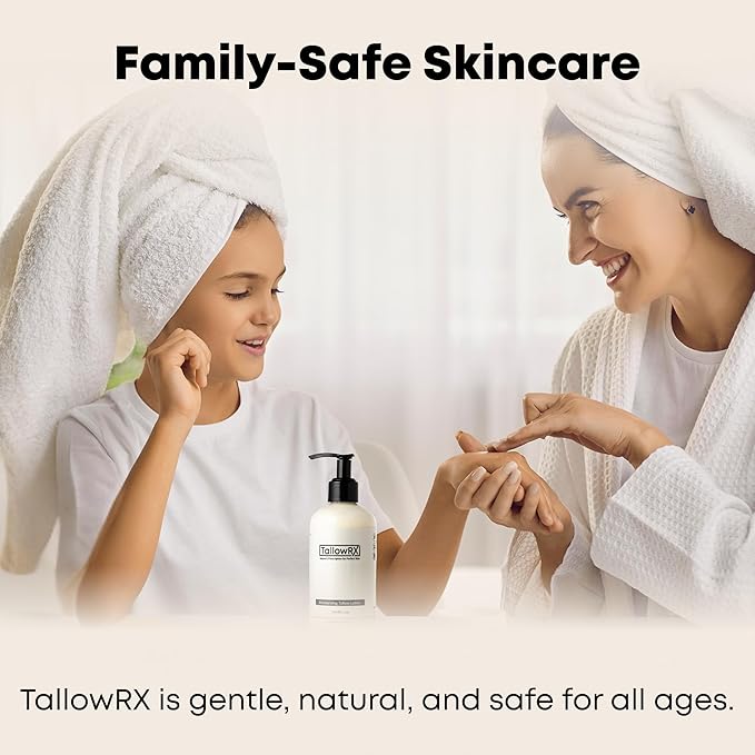 TALLOWRX Tallow Body Lotion – 100% Grass-Fed Beef Tallow for Skin, Face & Body – Pure & Organic Moisturizer with Jojoba Oil, Vitamin E (8 Fl Oz, Vanilla)