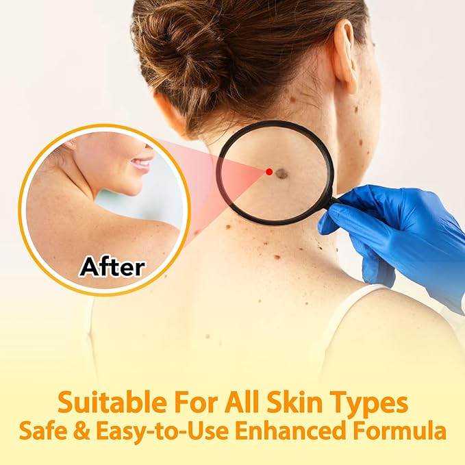 Bee Venom Cream for Face & Body – Hydrating Moisturizing Cream for Dry Skin, Soothing Lotion 3.52 oz