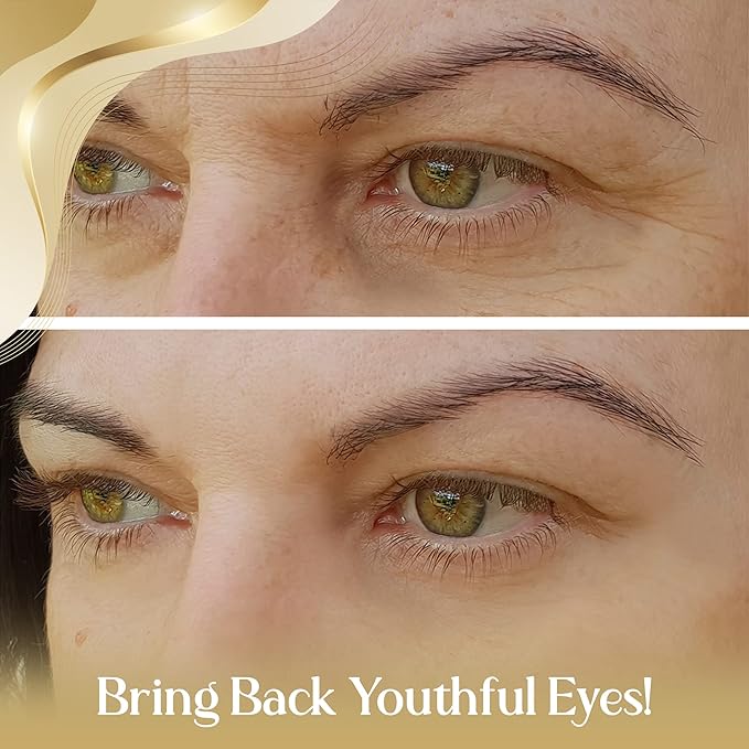 OROGOLD 24K Intensive Eye Serum - Under Eye Serum to Help Reduce the Look of Dark Circles and Puffiness - Gold, Green Tea, Aloe Vera and Vitamin C - 1.76 Fl. Oz.