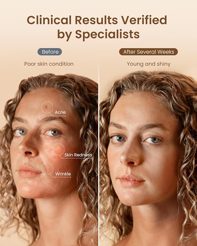 RENPHO Red Light Therapy Mask for Face 2026, Valentines Day Choice for Women Mom Wife, 324 LEDs Full Face Coverage & 3 Light Modes, Cordless LED Red Light Therapy Face Mask for Home Use & Travel