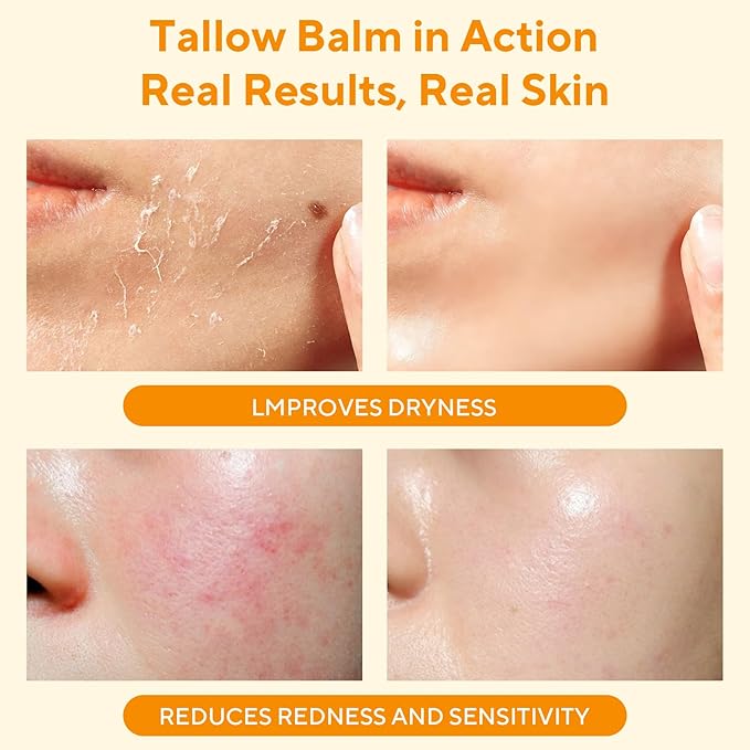 Beef Tallow for Skin, Tallow and Honey Balm, 5 oz Organic Grass-Fed Whipped Beef Tallow Cream, Deep Moisturizing Facial & Body Balm, 100% Natural Face Moisturizer for All Skin Types