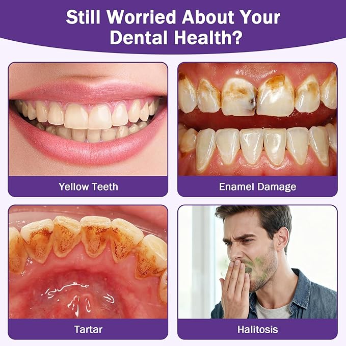 Teeth Whitening Powder, 2PCS Purple Toothpaste Whitening Powder | Teeth Whitening & Removes Stains & Breath Freshener | Hydroxyapatite, R5X Remineralizing for Coffee, Tea, Food, Wine, Tobacco Stains
