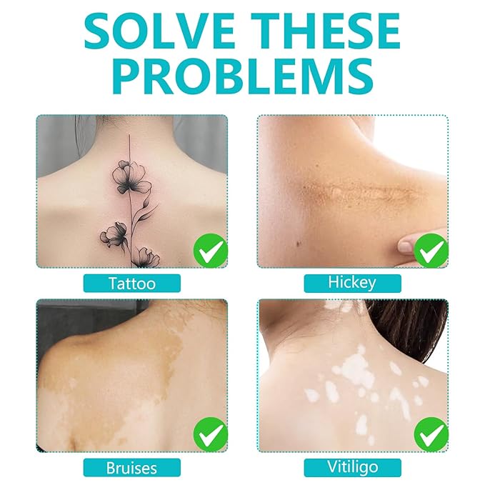 Tattoo Cover Up Makeup Waterproof, Full Coverage Concealer for Tattoos, Dark Spots & Scars, Long Lasting, Smudge-Proof & Transfer-Resistant