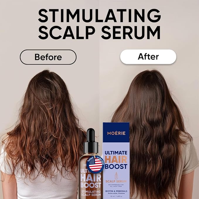 MOERIE Ultimate Hair Growth Serum for Natural Hair Regrowth & Thickening - Anti Thinning & Hair Loss Treatment for Women - Rapid Hair Growth Products - Scalp Oil Alternative - 1.69 fl oz / 50 ml