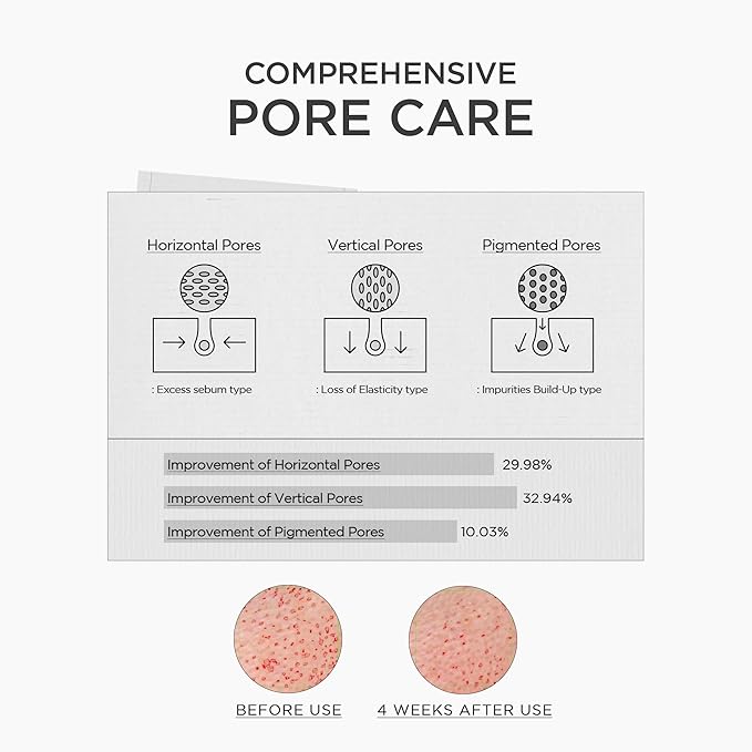 SKIN1004 Niacinamide 10% Boosting Shot Ampoule, Niacinamide Spicule Serum for Face, Facial Ampoule with Tranexamic Acid, Pore Minimizer for Face, Madagascar Centella, Korean Skin Care, 1.01fl.oz/ 30ml