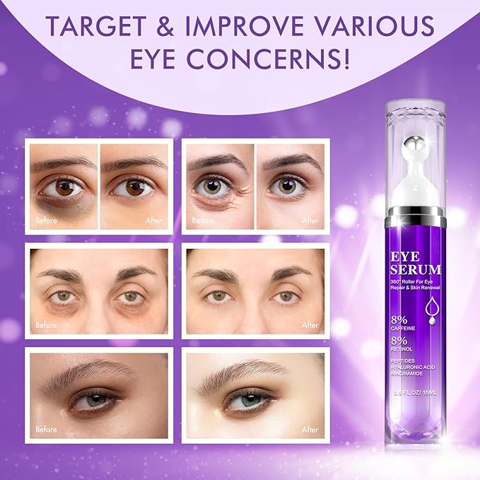 Advanced Eye Serum,8% Caffeine 8% Retinol Eye Treatment Cream,for Dark Circles Under Anti Aging Eyes Under Serum with 360°Massage Roller for Massage Ball 0.5 fl.oz
