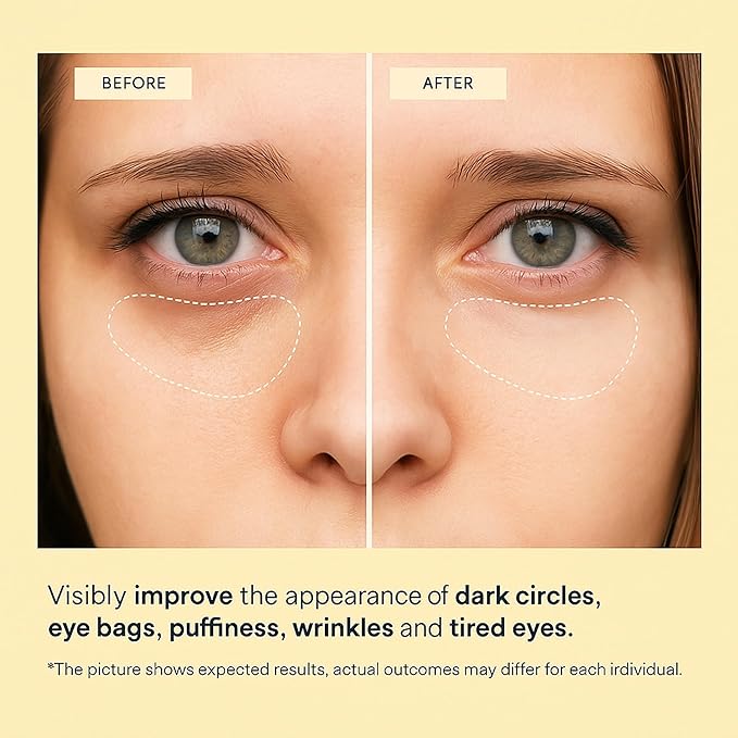 MAVENI 24K Gold Eye Mask-Under Eye Patches for Dark Circles-60 Pcs for Puffy Eyes,Anti-Aging,Bags & Wrinkles,Boost Lift & Firm the Look of the Eye Area,Hydrating, Anti-Wrinkle & Cooling
