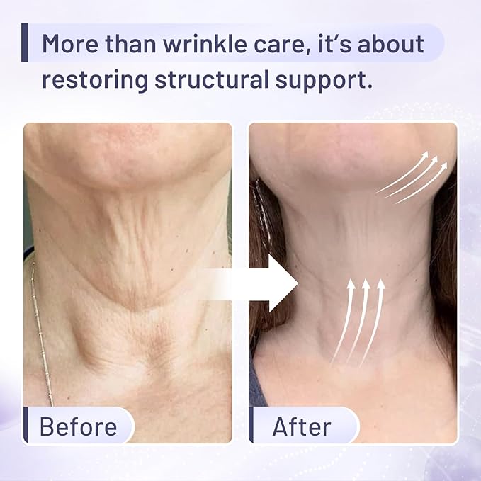 Premium Neck Firming Cream – Lifting & Tightening Treatment for Décolleté and Chest, Anti-Aging Neck Cream Reduces Fine Lines and Sagging, Gift for Women & Men, 2.03 Fl Oz