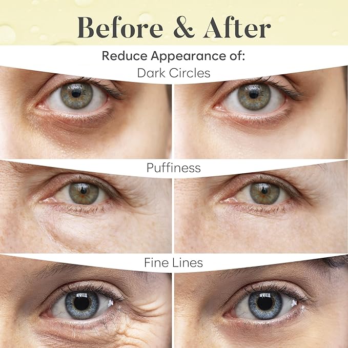 AURAE Green Tea Under Eye Patches (30 Pairs) - For Dark Circles & Puffiness - Hydrating Green Tea Eye Mask