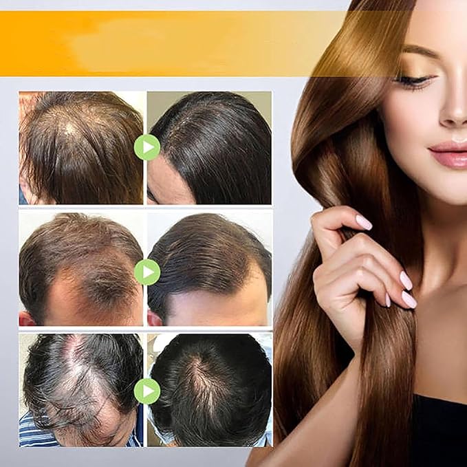 Onest Cosmetics Anti-Greying Hair Growth Oil, Onestcosmetics Anti Greying Hair Growth Oil Enriched with Amla and Sunflower,Onest Cosmetics Rosemary Hair Oil Serum Anti Hair Loss Nourishing Serum