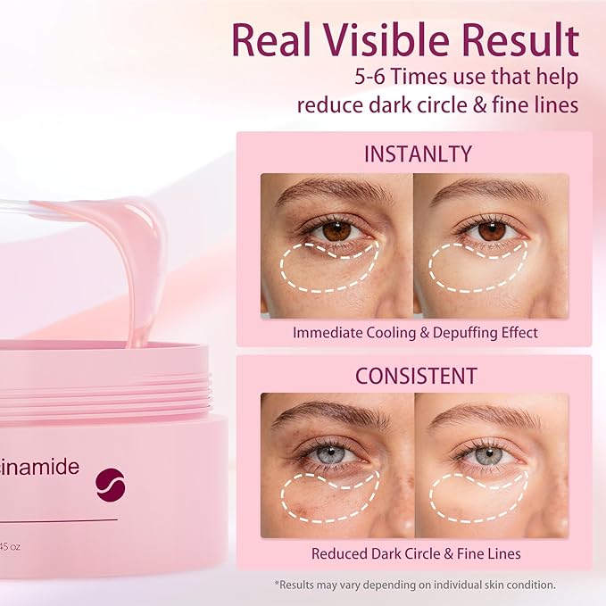 70Pcs Caffeine Peptide Under Eye Patches for Dark Circles Puffiness, Gel Eye Masks with Rose Essence Hyaluronic Acid Niacinamide Anti Wrinkle & Fine Lines Hydrating & Cooling for Men & Women