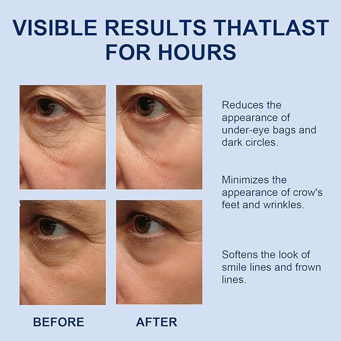 Under-Eye Bags and Wrinkles: Rapid-Reduction Serum, Instant Face Lift Cream. Anti-aging formula. Visibly reduces under-eye bags, wrinkles, dark circles, fine lines, and crow’s feet. 0.35 oz