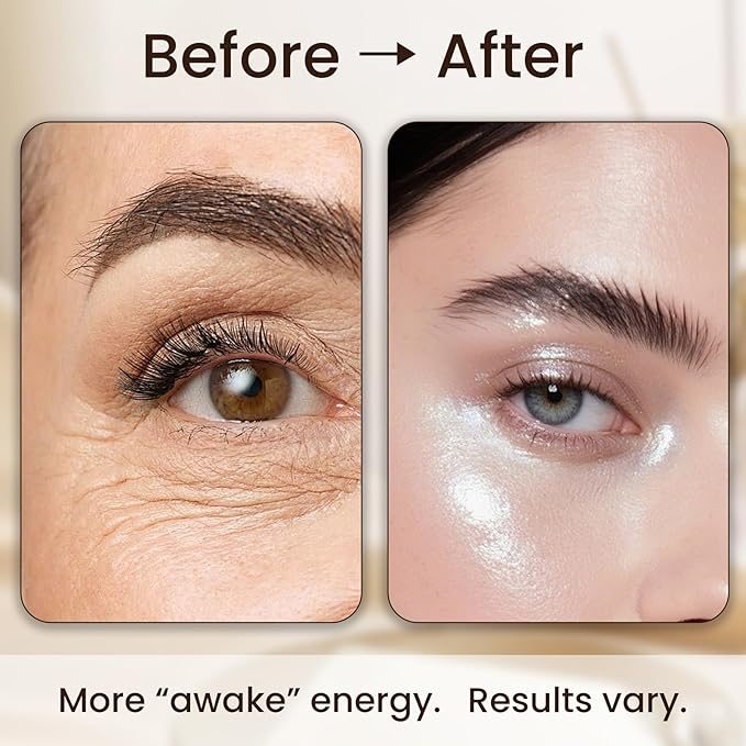 Retinol Eye Balms Repair Dark Circle, Eye bags and Puffiness, wrinkles,Firming Anti-Aging Eye Treatment, 15 ml