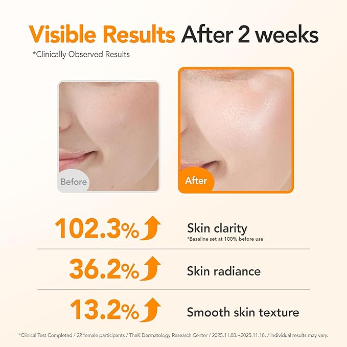 BALOOM 10% Niacinamide Serum with Glutathione, Dark Spot Remover For Face, Korean Skin Care for Uneven Tone, Discoloration & Pore Minimizing – Brightening Serum for Hydration & Glass Skin – 1.69 fl oz