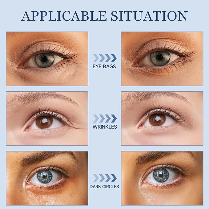Under Eye Bags and Wrinkles, Under Eye Cream for Puffiness and Bags, Temporary Instant Firm Lifting Cream, 15g Rapid Eye Cream Visibly Reduces for Bags Under Eyes Bags Dark Circles Men Women