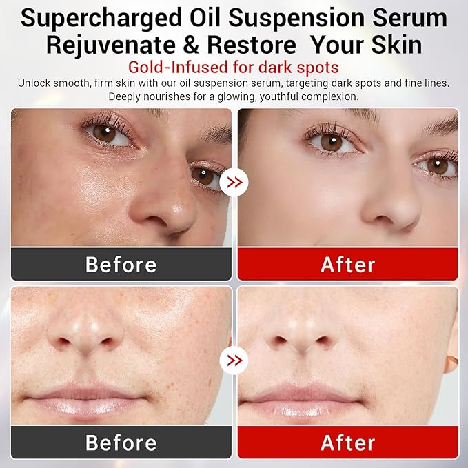 Emergency Repair Oil Suspension Serum | 99% Active skin Repair with Collagen + HA + CICA | Anti-Aging, Water-Balance,Ultra Hydrating, Instant Face Lift Korean 30x (Oil Suspension Serum)
