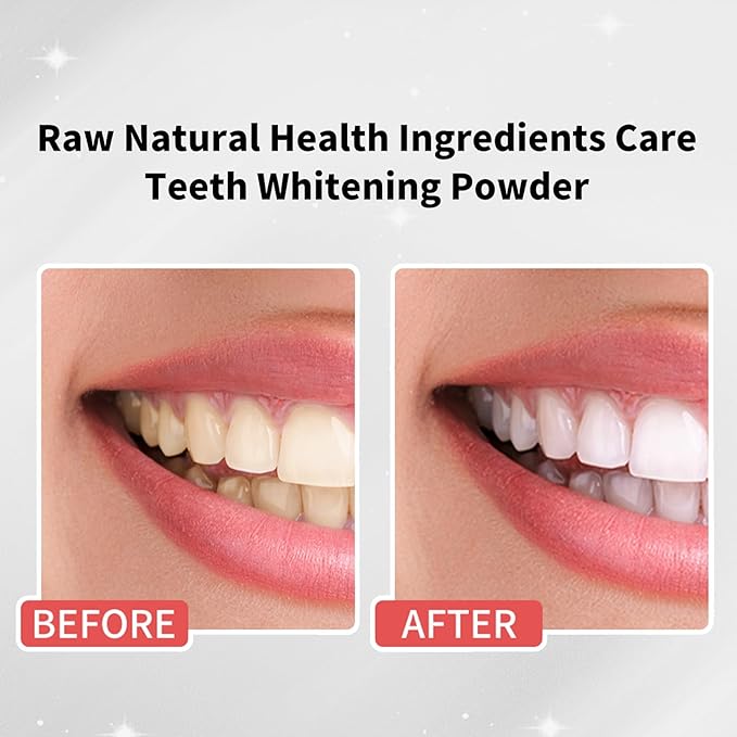 KeLeek 7 Benefits Hydroxyapatite Remineralizing Tooth Powder Toothpaste - Bee Wasp Venom Teeth Whitening Powder - Lemon Mint Flavor -1.760Z